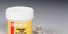 Silver-filled Adhesive