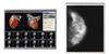 High luminance 21.3-inch UXGA LCD module