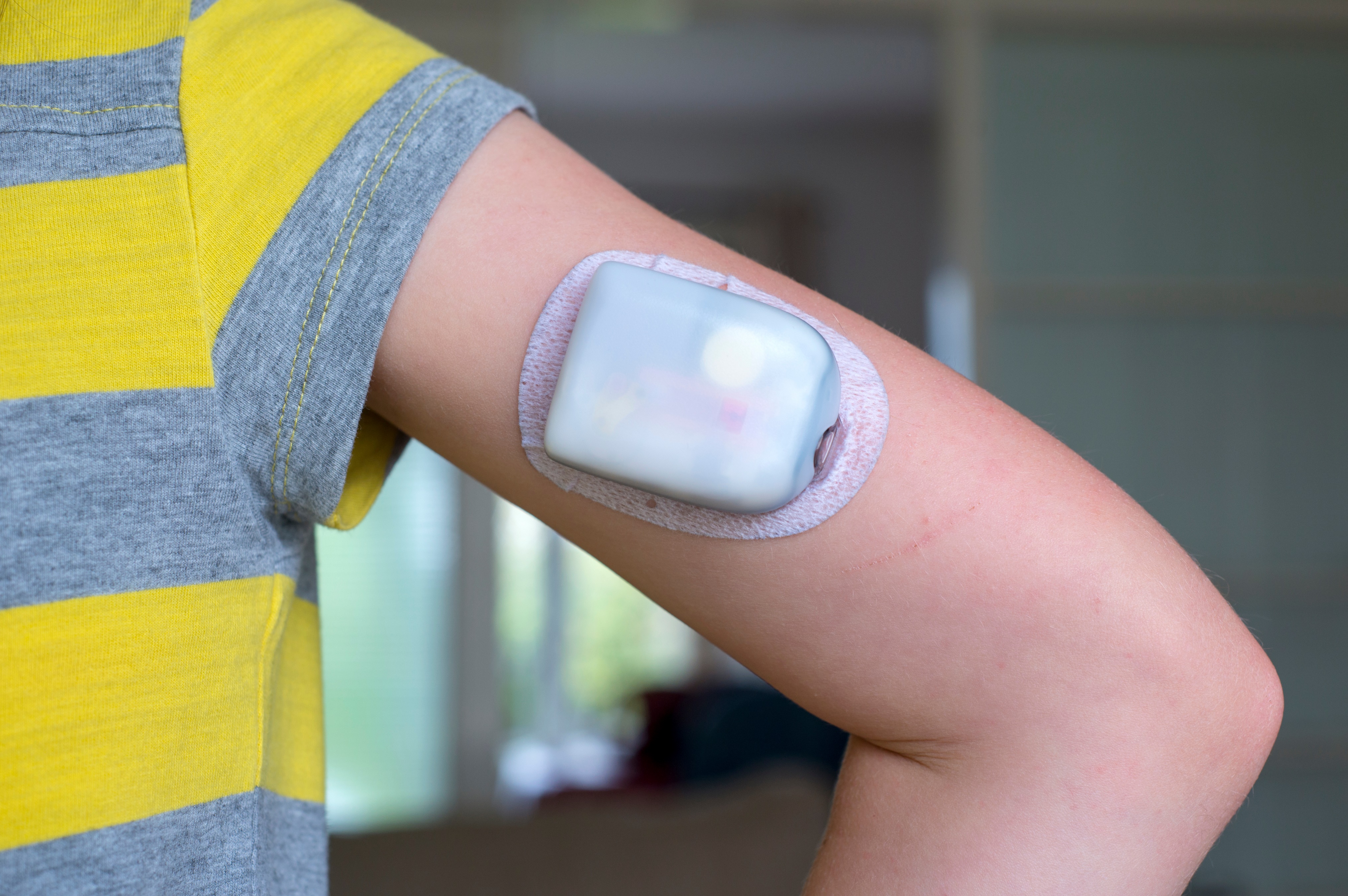 Motion Filter Medical Disposable or Reusable: Designing a Motion System for Medical Devices